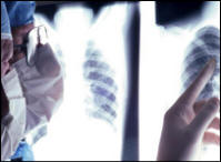 Image of chest x-ray