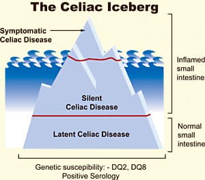 celiac iceberg
