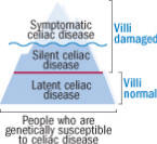 The celiac iceberg